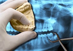 X-rays and model of tooth to be extracted