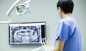 Dentist looking at digital x-rays