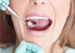 Closeup of paitent receiving dental exam